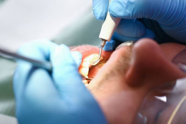 Best Emergency Gum Pain Relief  in Oak Hills Pce, LA